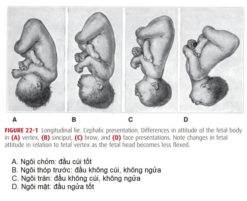 Các dạng ngôi thai đầu
