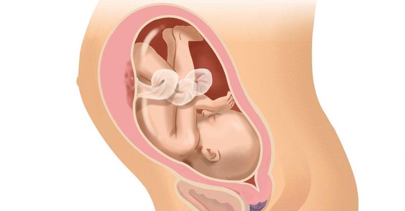 Ngôi thai đầu là vị trí ngôi thai thuận lợi cho sinh nở
