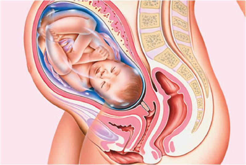 Ngôi thai thuận có thể sinh thường hoặc mổ