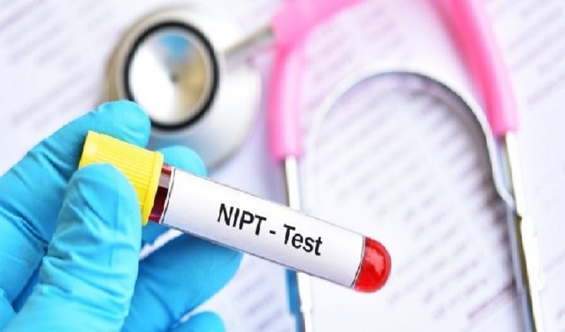 Xét nghiệm NIPT là gì