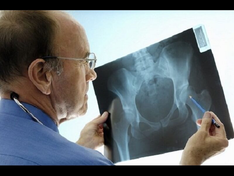 Dùng ảnh X quang để chẩn đoán chấn thương